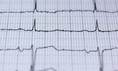 ECG Elettrocardiogramma