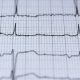 ECG Elettrocardiogramma